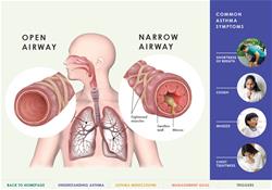 asthmaflipchart2